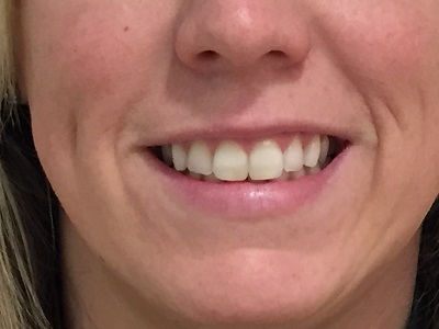 Photo of teeth not taken by selfie